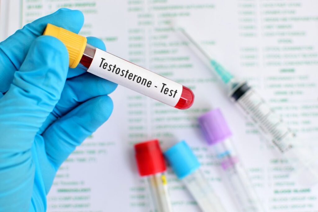 testosterona